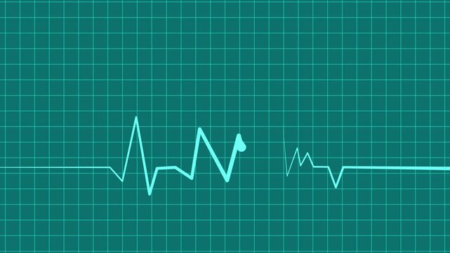 Zigzag line sharp rise and fall suggesting data heart rhythm wave pulse animation