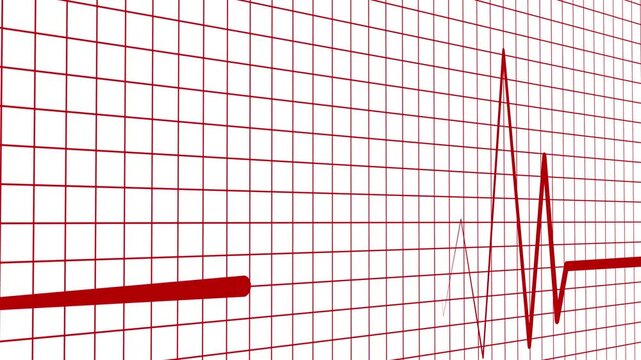 Heart rhythm line heartbeat spikes and flat line showing medical pulse and emergency concept animation