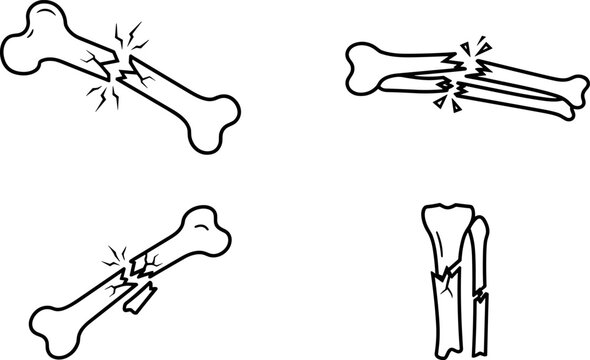 Collection of broken bone fracture icons