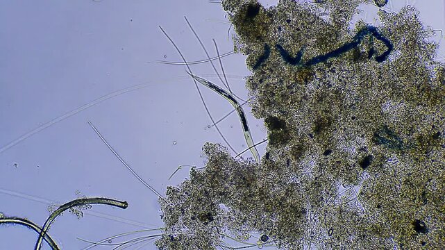 Micro organism - Nematode worm