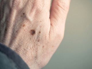 Naklejka premium Close up of an elderly hand with age spots and dry skin showing natural texture and signs of aging for dermatology wellness and skincare concepts