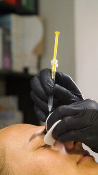 Injections of skin-lifting treatments. Mesotherapy. Close-up of female face during youth restoration and facial rejuvenation procedure.