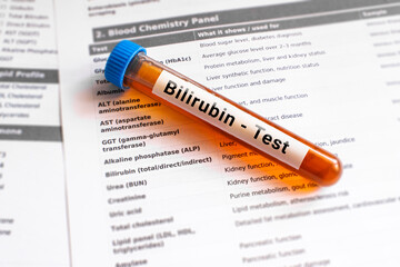 blood sample in lab tube for Bilirubin test