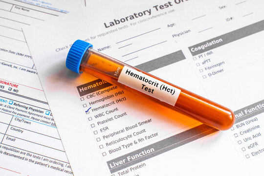 blood sample in lab tube for Hematocrit (Hct) test