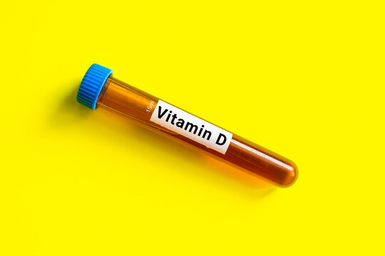 blood sample in lab tube for Vitamin D test