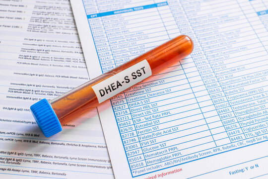 blood sample in lab test tube for DHEA-S SST