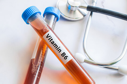 blood sample in lab test tube for Vitamin B6