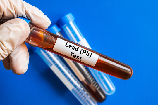 blood sample in lab test tube for Lead Pb