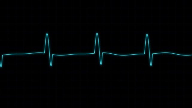 Neon blue ekg heartbeat monitor loop: medical diagnostic pulse wave on dark grid background