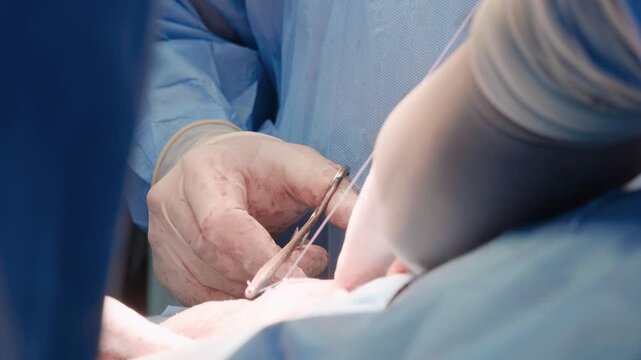 Close Up of Surgeon Hands Pulling Suture Thread with Surgical Scissors During Operation
