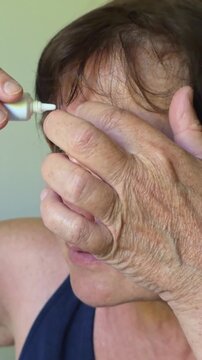 A woman is using a treatment on a pimple at home. vertical video.