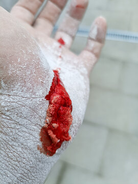 Bleeding cut on a dusty worker hand showing workplace injury, occupational hazards, construction safety risks, and emergency first aid context