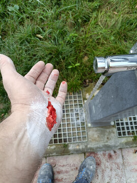 Bleeding cut on a dusty worker hand showing workplace injury, occupational hazards, construction safety risks, and emergency first aid context
