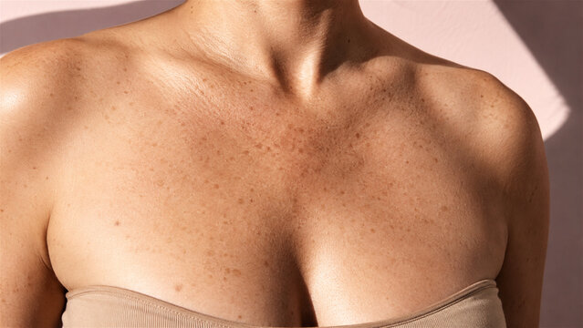close up of a woman&rsquo;s bare shoulders and chest with visible freckles and natural skin texture. Body positivity, skincare, self acceptance, and authentic beauty concept