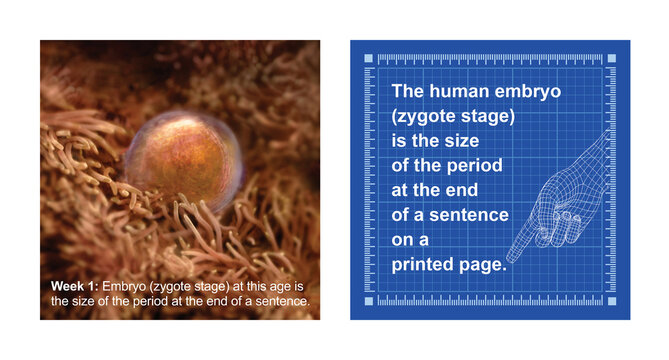 Embryo alive in the uterus 1 week following fertilization and wireframe images for size reference