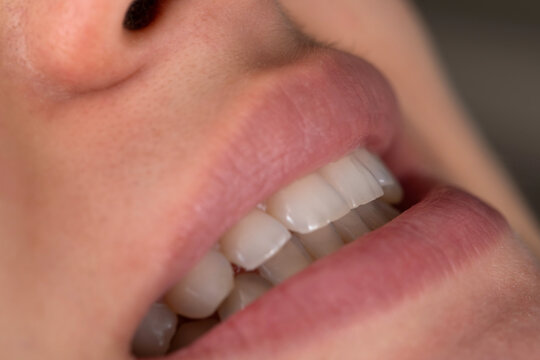 Smiling with perfect white teeth