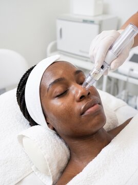 A Black woman with braided hair receives a hydrafacial treatment as a gloved specialist uses a facial device, a skincare and dermatology concept.