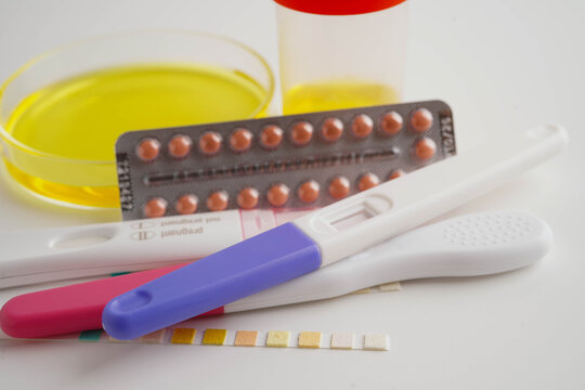 Urinalysis, urine cup with reagent strip pH paper test and comparison chart in laboratory.