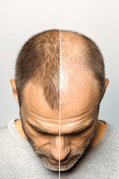 Side-by-side view highlights a man's transformation from thinnin