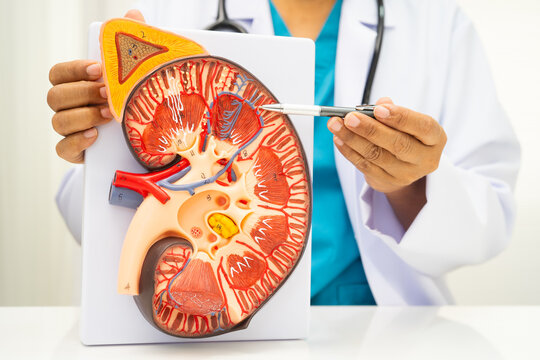 Kidney disease, Chronic kidney disease ckd, Doctor hold human model to treat and study in hospital.