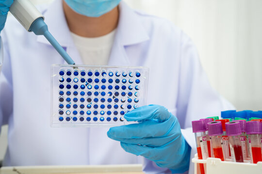 Scientist with cell culture in sample micro plate for research in science laboratory.