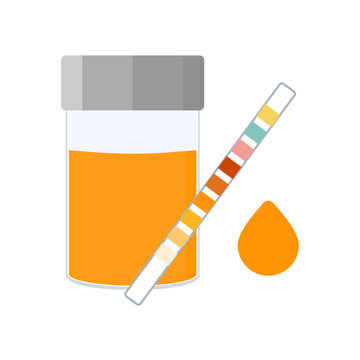 Urine sample cup and urinalysis reagent strip for kidney exam, urinary tract infection and cystitis diagnostics. Ketone and PH rapid test strips for ketogenic and alkaline diets. Vector illustration.
