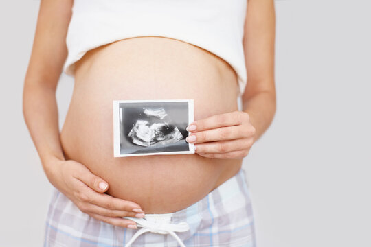 Hands, pregnant woman and sonogram picture on stomach for baby growth, maternity and ultrasound scan. Mother, pregnancy and photo on abdomen closeup for prenatal health on white studio background
