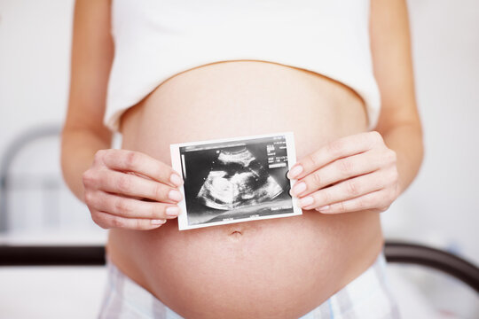 Hands, pregnant woman and sonogram photo on stomach for baby growth, maternity and ultrasound scan. Mother, pregnancy and picture on abdomen closeup for prenatal health, development or care in home