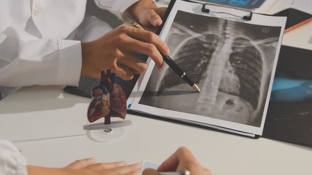Doctor holding and pointing to an anatomical model of human lungs in a clinical office setting
