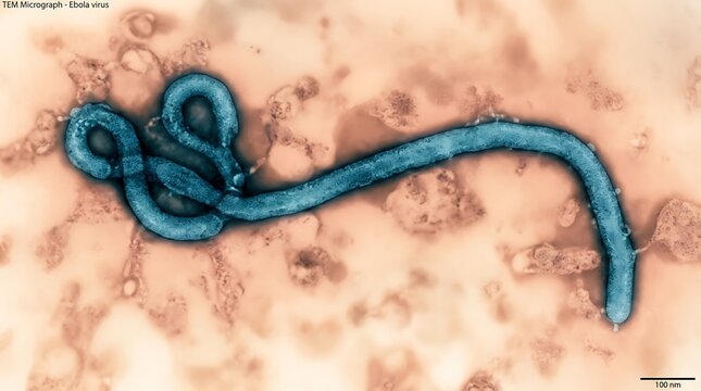 Transmission Electron Micrograph of Ebola Virus Particles Under Laboratory Microscope View