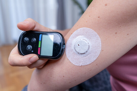 A woman holds a handheld glucose monitor next to a continuous sensor patch on her arm, a concept of diabetes management and wellness technology at home.