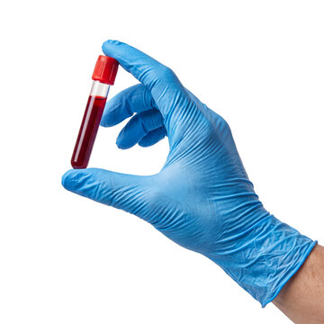 Gloved hand holding a blood sample test tube with red liquid for laboratory analysis, isolated on transparent.