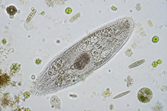 Protozoan with cilia in water sample, microbiology concept