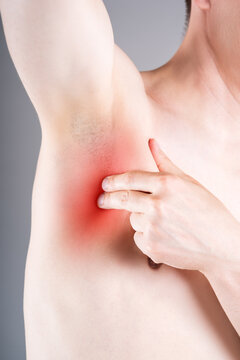 Close up of man touching painful armpit with red highlighted spot, swollen lymph nodes or axilla inflammation concept