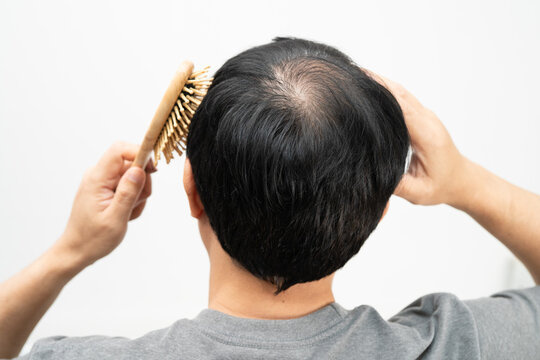Bald in the middle head and begin no loss hair glabrous of mature Asian business smart active office man.
