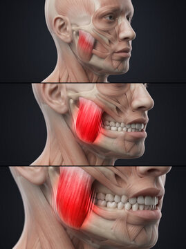  3D medical animation of jaw trismus and muscle lock
