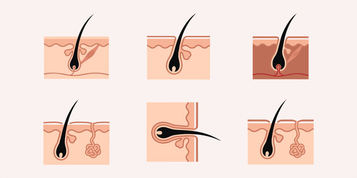 Hair follicle anatomy and skin structure vector set for scalp care and dermatology concept