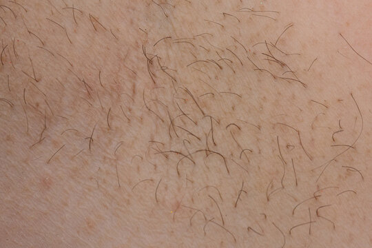 Human skin surface with visible hair follicles and stubble