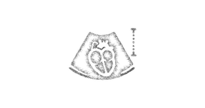 Sketch echocardiogram icon animation - smooth progressive reveal