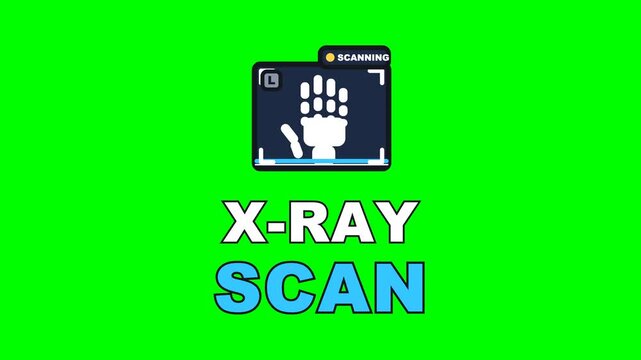 4K green screen X-RAY SCAN animated text - the scan bar raking down the lightbox, kinetic typography clinic and healthcare overlay for medical content and social media, chroma key