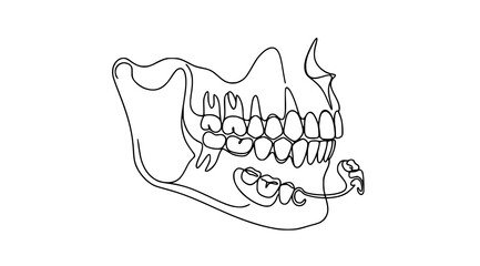 Human Upper Lower Jaw Teeth Dental Prosthetic Technology One Line Vector Illustration © MdMiraz