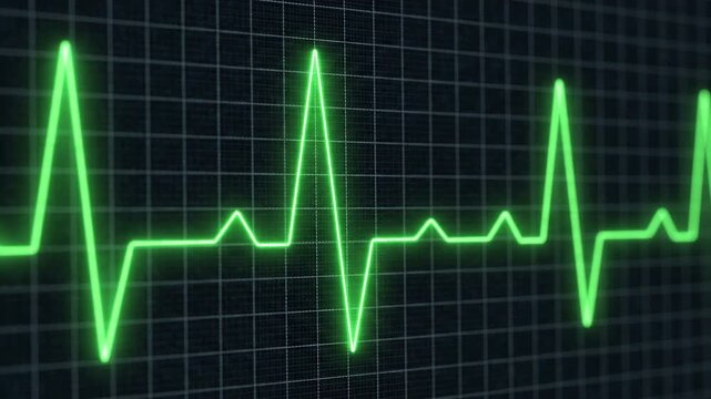 Digital ECG waveform progression on dark grid background with selective focus during medical monitoring concept