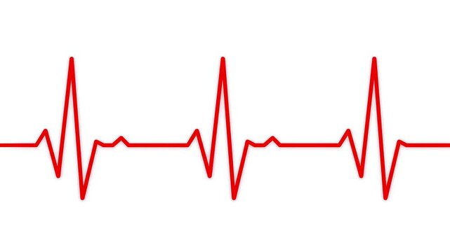 ECG heart rhythm graphic evolving with increasing beat frequency in clean white background