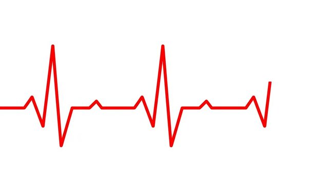 ECG heart rhythm line evolving in motion against a clean white background with subtle horizontal black bars for graphic design