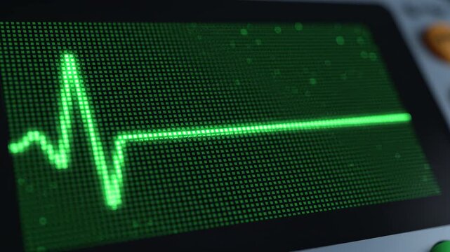 ECG heartbeat waveform transitioning to flatline during medical monitoring in a dimly lit examination room