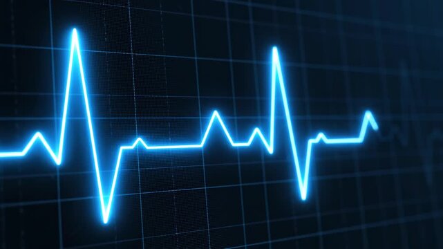 Electrocardiogram heartbeat wave moving across a digital monitor with grid background during a medical checkup