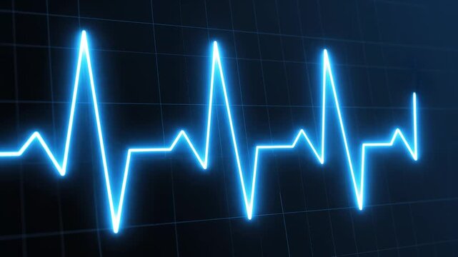 Electrocardiogram line moving on a dark blue grid during a medical diagnostic examination