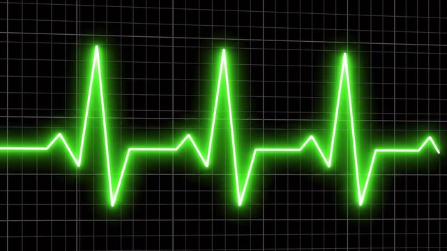 Green EKG heart rate line graphic evolving over time against a dark grid background with subtle cinematic motion
