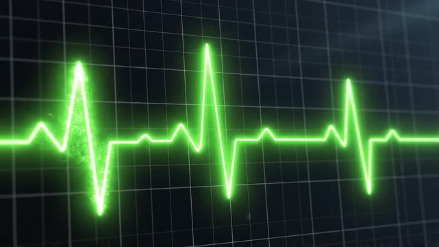Green EKG heart rhythm pulsating on a dark digital monitor screen with subtle camera zoom out
