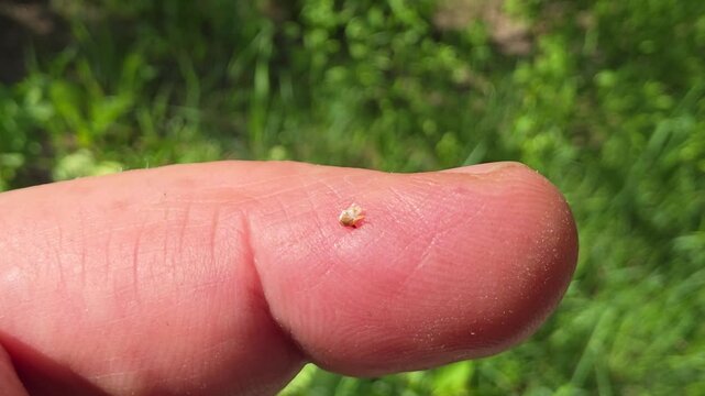 The sting with a bubble of poison. 
The sting with a bubble of poison resembles a medical syringe.

